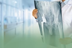 Understand the Benefits of the Anterior Approach to Hip Replacement Surgery